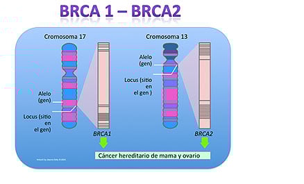 CÁNCER DE MAMA CÁNCER DE MAMA